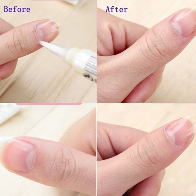 1pcs Cuticle Oil Pen Nail Nutr - Cuticle Oil Pen recension och pris